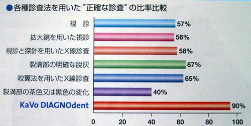 ���[�U�[����p�������V���T�m�@��@DIAGNOdent�i�J�{�@�_�C�A�O�m�f���g�j