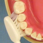 歯ブラシの当てる角度